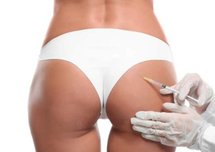 Biopolímeros: la peligrosa realidad detrás de los modelantes estéticos