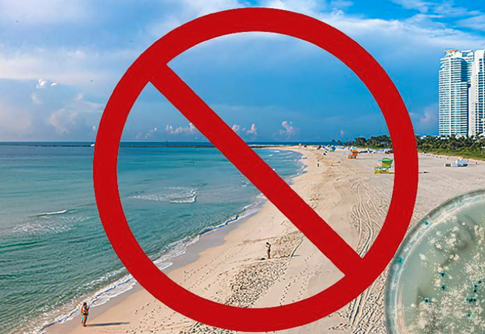 Alerta sanitaria en dos playas de Miami-Dade por contaminación bacteriana